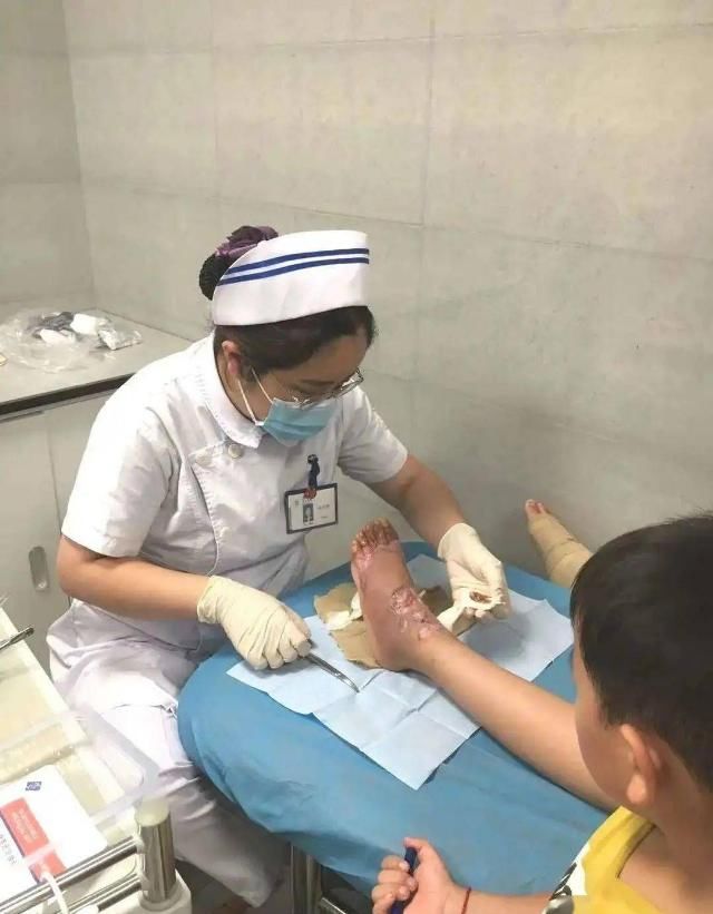  烫伤|烫伤偏方害人不浅！小姑娘的双腿不忍直视……