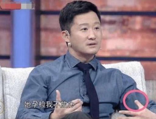 耳朵|明星也有身体缺陷，第三位不仔细看看不出来，最后一位在女人面前自卑！