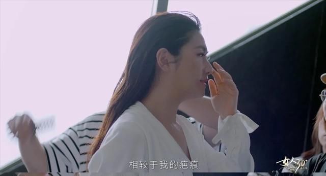  镜头|烧伤第十年面对镜头，Selina哭了！但她不是公主了，不需要可怜