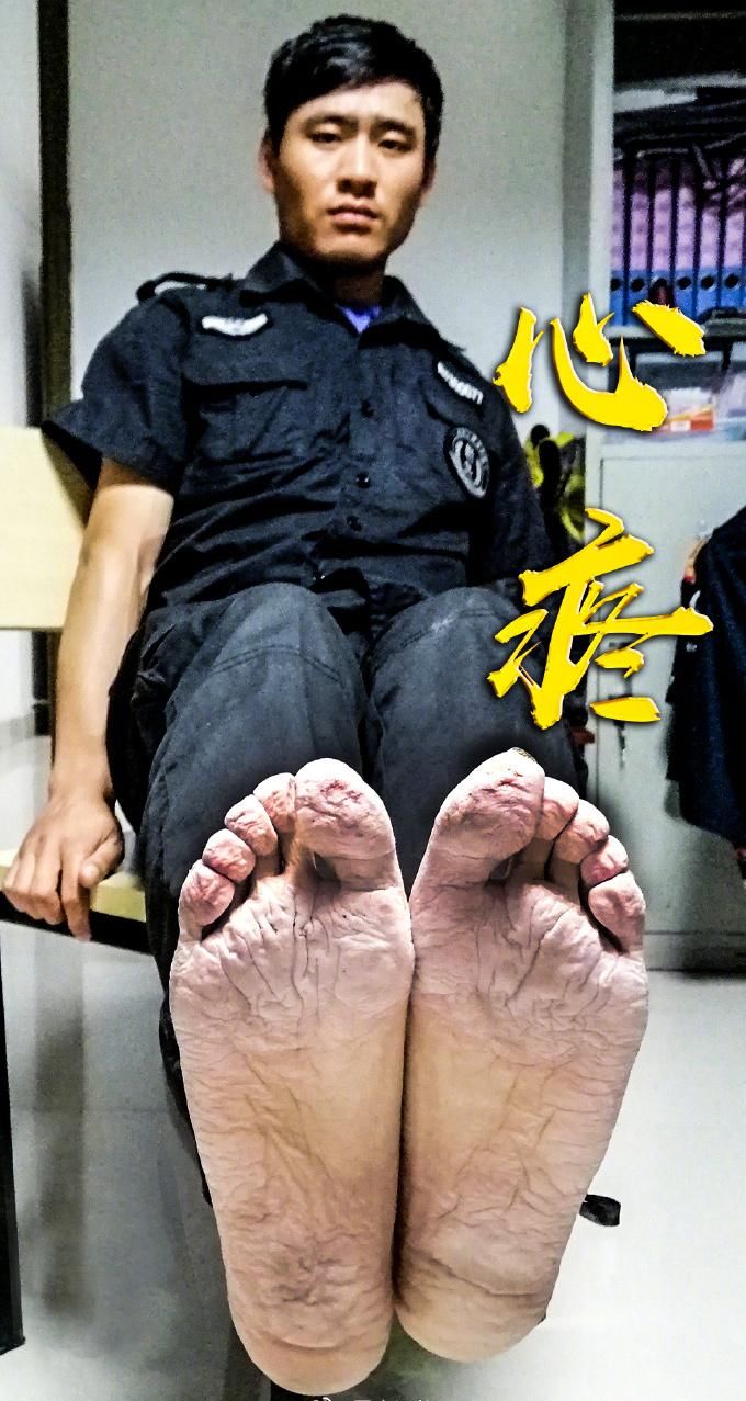  日行|日行3万步 28岁小伙子的这双脚让人心疼！