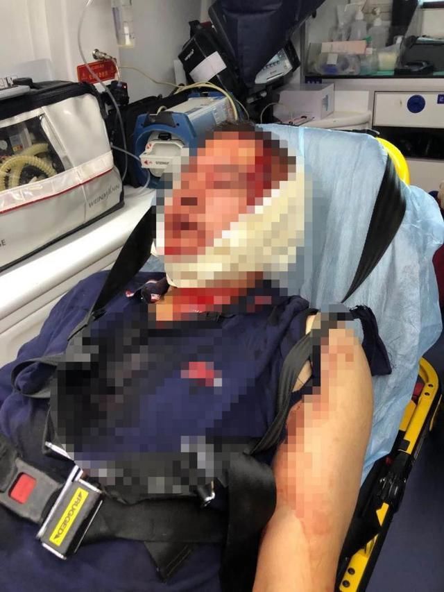 家长|两小学生闹矛盾，两位爸爸却约架打到头破血流，警方已介入