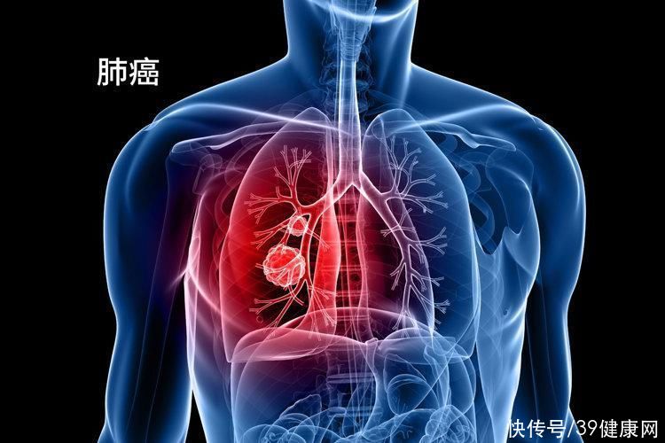 72岁肿瘤专家患癌赴美抗癌(72岁肿瘤专家患癌，赴美抗癌一年离世，临终前2个反思，引以为戒)