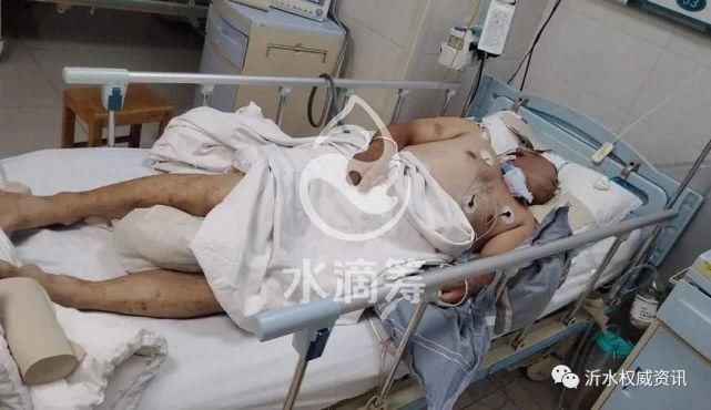  沂水|沂水大街上这个卖油条的，已经半个月不出摊了。