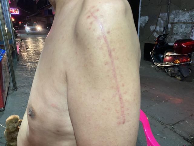 北京头条记者|因戴口罩男子被打伤 伤人者获刑八个月后检方抗诉 受害人希望对方得到严惩