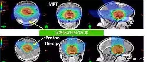 他把头伸进了粒子加速器,直接被接近光速的