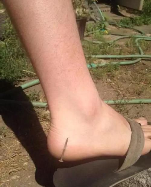  当场|生活中38个最危险的瞬间，离当场去世就差那么0.01秒