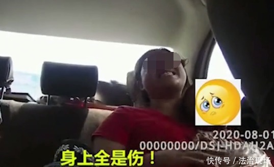  声嘶力竭|怕孩子睡着再也醒不来！幼童被恶犬咬伤满身血，母亲声嘶力竭呼救