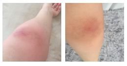 部位|怎样坚持拍打同一个部位一小时?