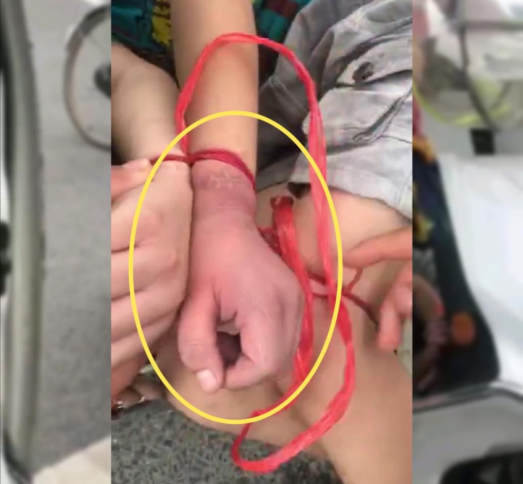  绑住|女子将9岁儿子绑住手脚塞在电动车座下方，孩子手发紫，胳膊出血