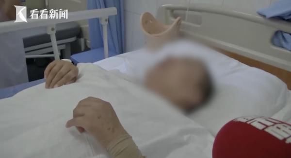  骨折|女子上班时从12楼坠落全身多处骨折 公司老板付了1万3失联