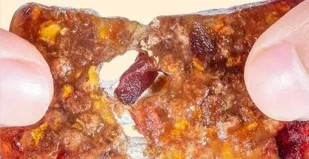  健脾|三伏天吃这种糕，健脾祛湿瘦得快，错过等一年！