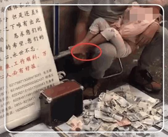行乞|男子抱着小女孩街头行乞,路人看清他手上的小动作后,果断报警