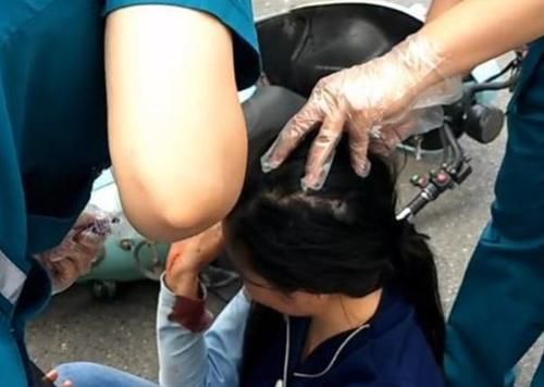  询问|女子骑电动车出车祸，当场就失忆了，询问交警：我在哪里？