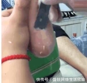  女子|女子3年没洗脚，出嫁前父母带去修脚，刮下来的死皮竟有1厘米厚
