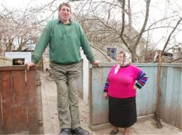 身高|国外男子前半生身高1.22米，后半生身高2.16米，全球只此一人