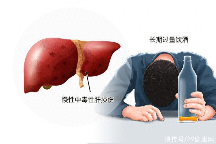长期喝酒会导致老年痴呆吗(超393万人的全国性研究：常喝酒不仅防痴呆，还能提高生活质量？)