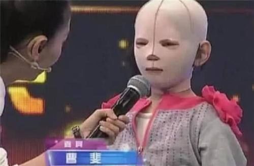 同学|女孩因一直戴“头套”上学,受尽同学嘲笑,摘下头套后众人沉默了