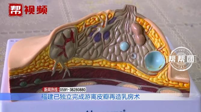 小婷|左乳皮肤潮红，一年内迅速扩散，发现时已是癌症晚期