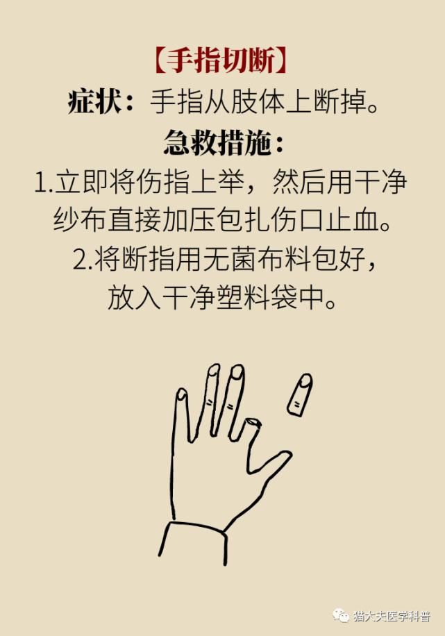  常识|人民日报总结14个急救常识，快收藏！
