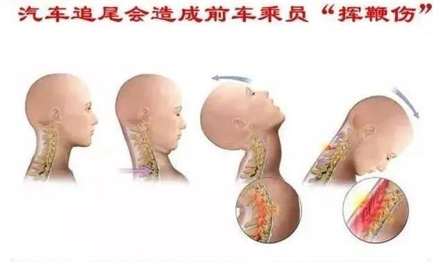  用途|为何汽车头枕怎么放都不舒服？因为你没弄明白它的用途，别错过了