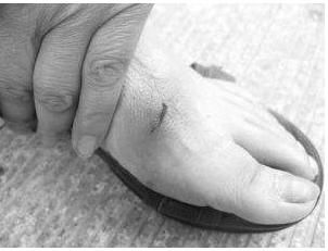  妈妈|老鼠因咬了小女孩脚趾后当场死亡，妈妈一看瞬间吓坏了