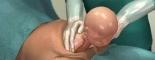 妈妈|1分钟看懂剖腹产顺产区别,男人最应该知道,理解做女人的不容易