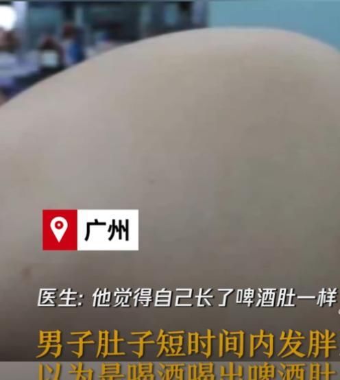  男子|男子一口冰啤下肚突感不适，肚子离奇胀大，医生的话让男子慌了