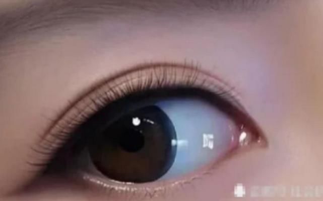 测试|心理测试:凭直觉,哪一只眼睛盯着你看?秒测目前有没有人暗恋你