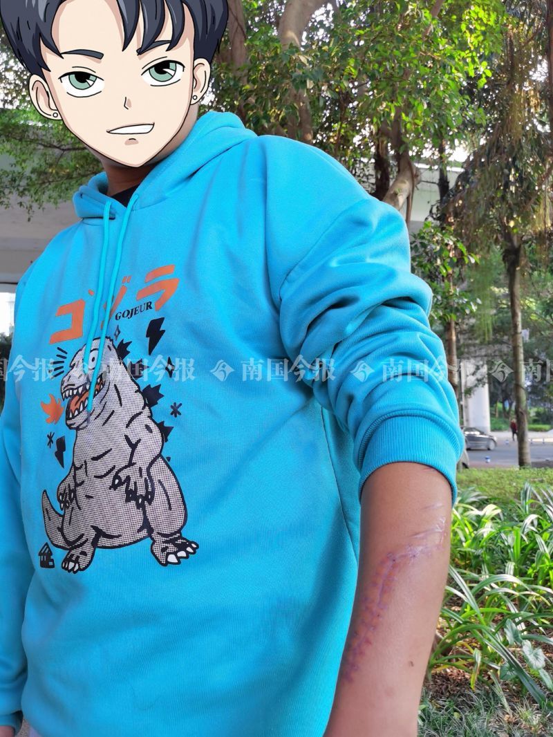 砍伤|柳州外卖小哥凌晨追贼被砍伤，案发8天后歹徒落网