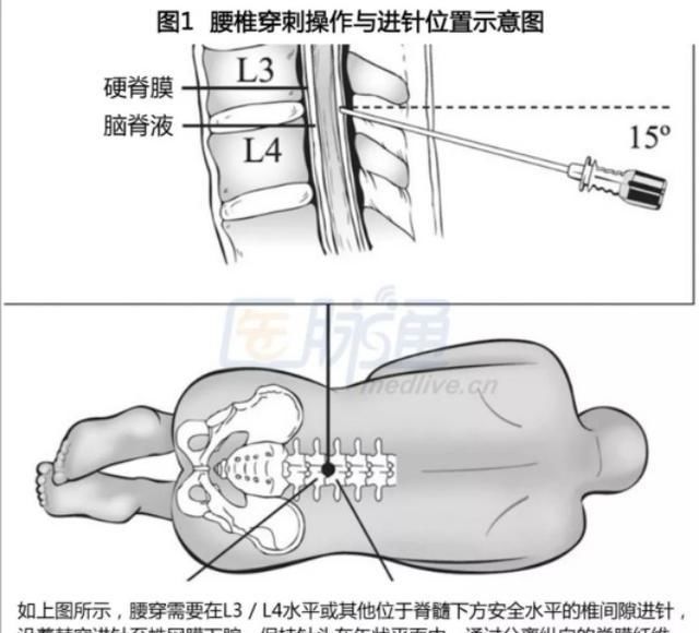  坠落|男孩19岁时高处坠落死里逃生，23岁又因脑炎昏迷，真是命途多舛！