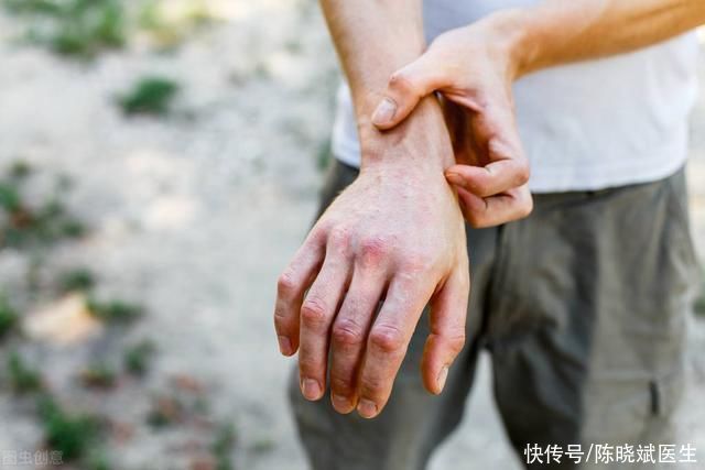 皮肤出现这5个异样可能是肾衰竭(错把肾衰竭当成皮肤病!提醒:皮肤出现3个表现，或是肾脏在求救)