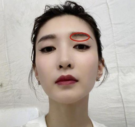  动刀|江疏影脸上动刀？近来频繁营销美貌的她，竟是医学的功劳？