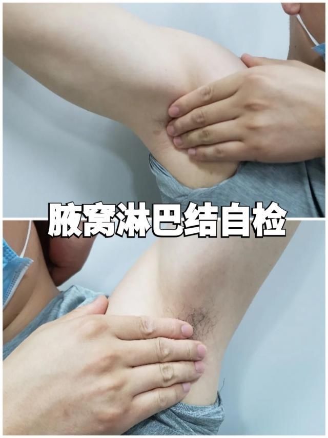  脖子|年轻姑娘在脖子上突然摸到一个包！脖子还越来越粗