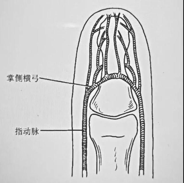  女子|爱做饭的人注意！深圳女子切菜时没留心，险些毁了一根手指