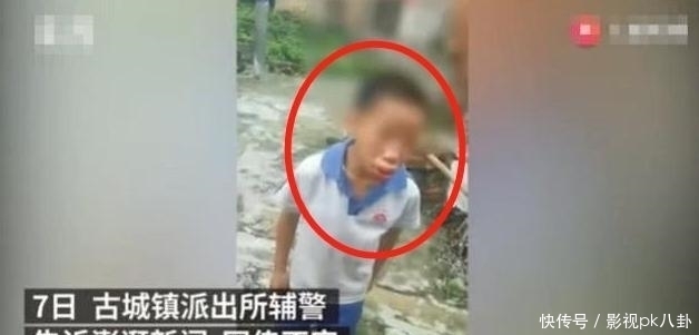 活该|12岁男孩被爸爸“揍成香肠嘴”，网友得知原因后真是活该