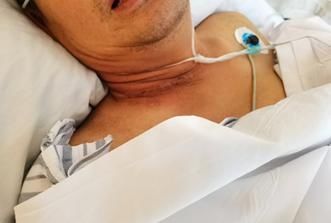 医生|惊险!工友不慎被扳手插入颈部 多学科医生合力抢救成功