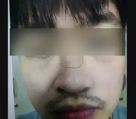 乘客|打起来了!上海地铁10号线2名乘客爆发冲突,一人鼻子被打断!起因仅是一把雨伞