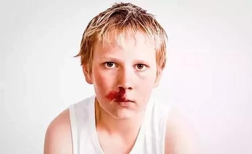孩子习惯性流鼻血,究竟是什么原因导致的?