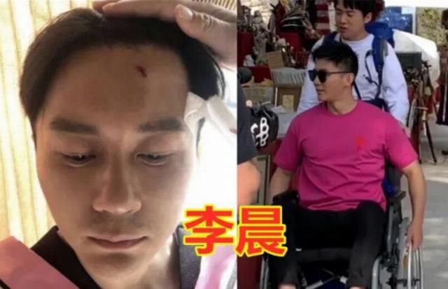  手指|明星录综艺时意外，张艺兴晕倒，baby手指骨折，她被搭档误伤！