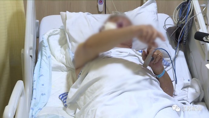  陈大伯|天气有多热？老伯摔了一跤，结果二级烫伤！医生的话让人心惊…