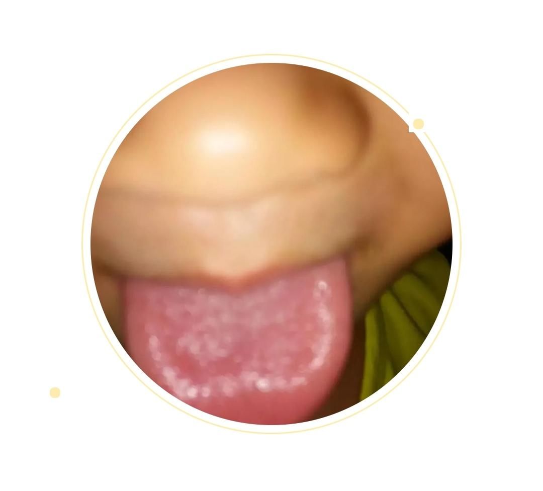  变化|身体健康情况怎么样？可以从舌头进行窥探