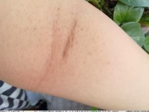  部位|怎样坚持拍打同一个部位一小时？