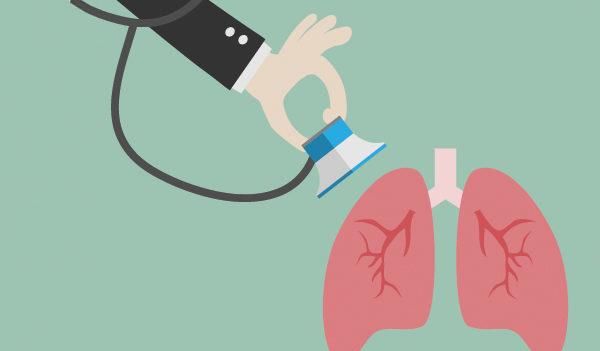 咳嗽|肺癌居癌症死亡第一,早期无症状,咳嗽别轻视