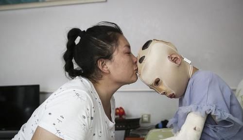  女孩|偷油贼焚车引发车祸致1死2伤，疑犯归案10岁女孩却惨遭毁容