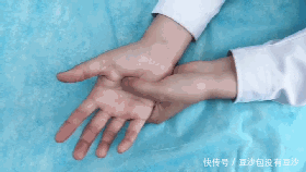 小林|27岁女子,突发猝死,身体出现1肿、2紫、3多,去查查心脏