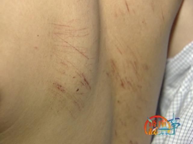  托举|女子深夜跳海，小伙跳水救人，水下托举半小时，浑身被划伤……