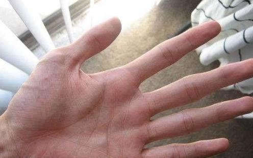 代谢|想知道自己的肝好不好只需“竖起中指”,看看就能知道了