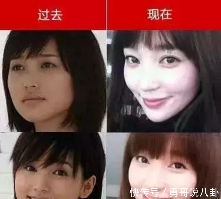 正骨|金莎硬核澄清整容谣言！脸部正骨听说过吗隔着屏幕都觉得脸疼