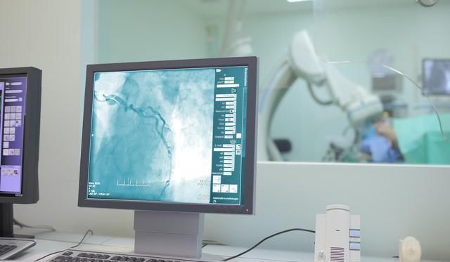 冠心病|冠心病患者有福了,在心脏上架起“桥梁”,能让生命重获“心”生