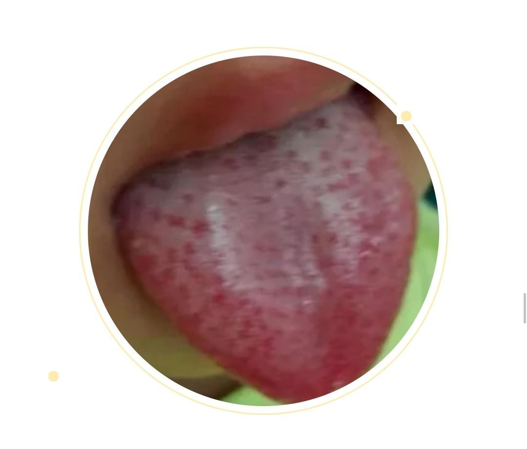  变化|身体健康情况怎么样？可以从舌头进行窥探